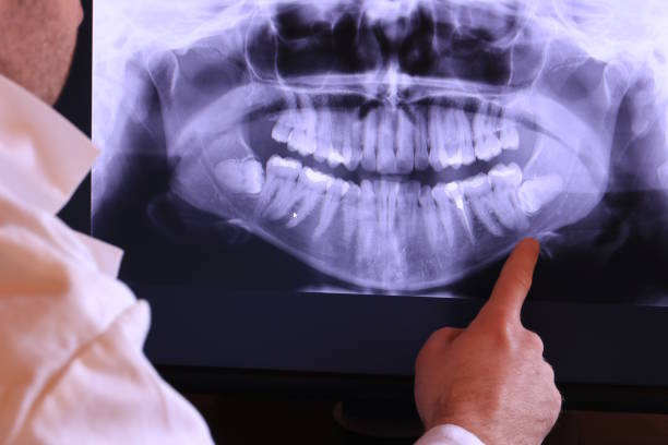 Best Emergency Root Canal Treatment in Abingdon, IL